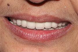 Digital Smile Design